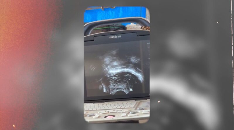 Estudo da Embrapa aponta antecipação de puberdade sexual em novilhas com ajuste energético